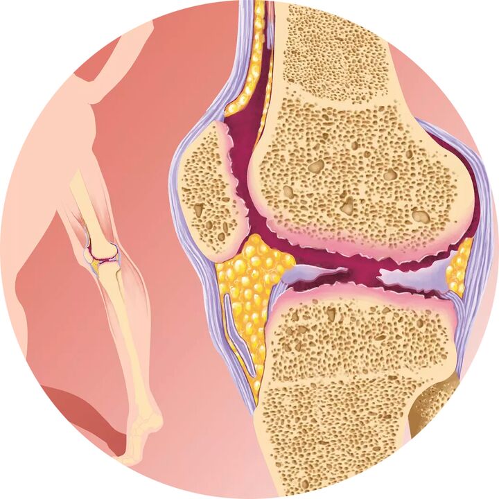 Hondroten – Suporta mobilidade articular