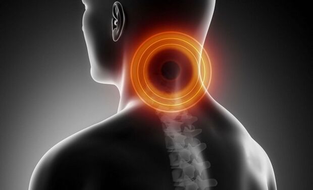 cervicalgia com osteocondrose cervical